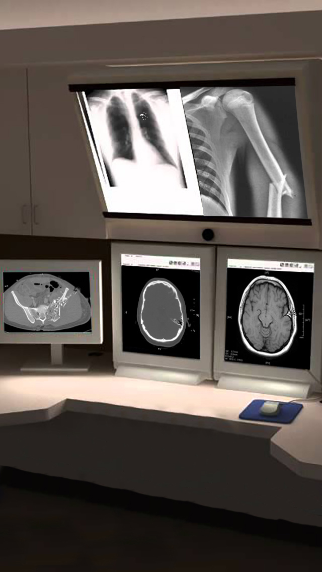INT. RADIOLOGY SCREEN – DAY
