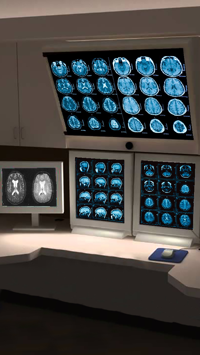 INT. RADIOLOGY SCREEN MRI – DAY